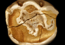 Dentes de leite Neandertal revelam seus segredos